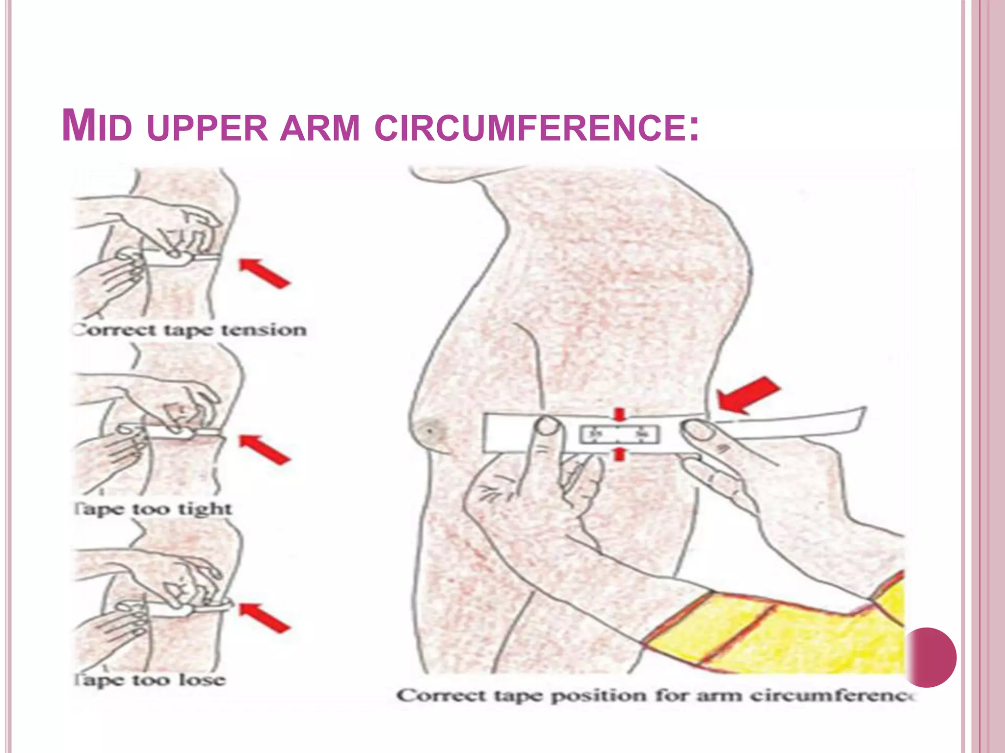 MID UPPER ARM CIRCUMFERENCE:
 