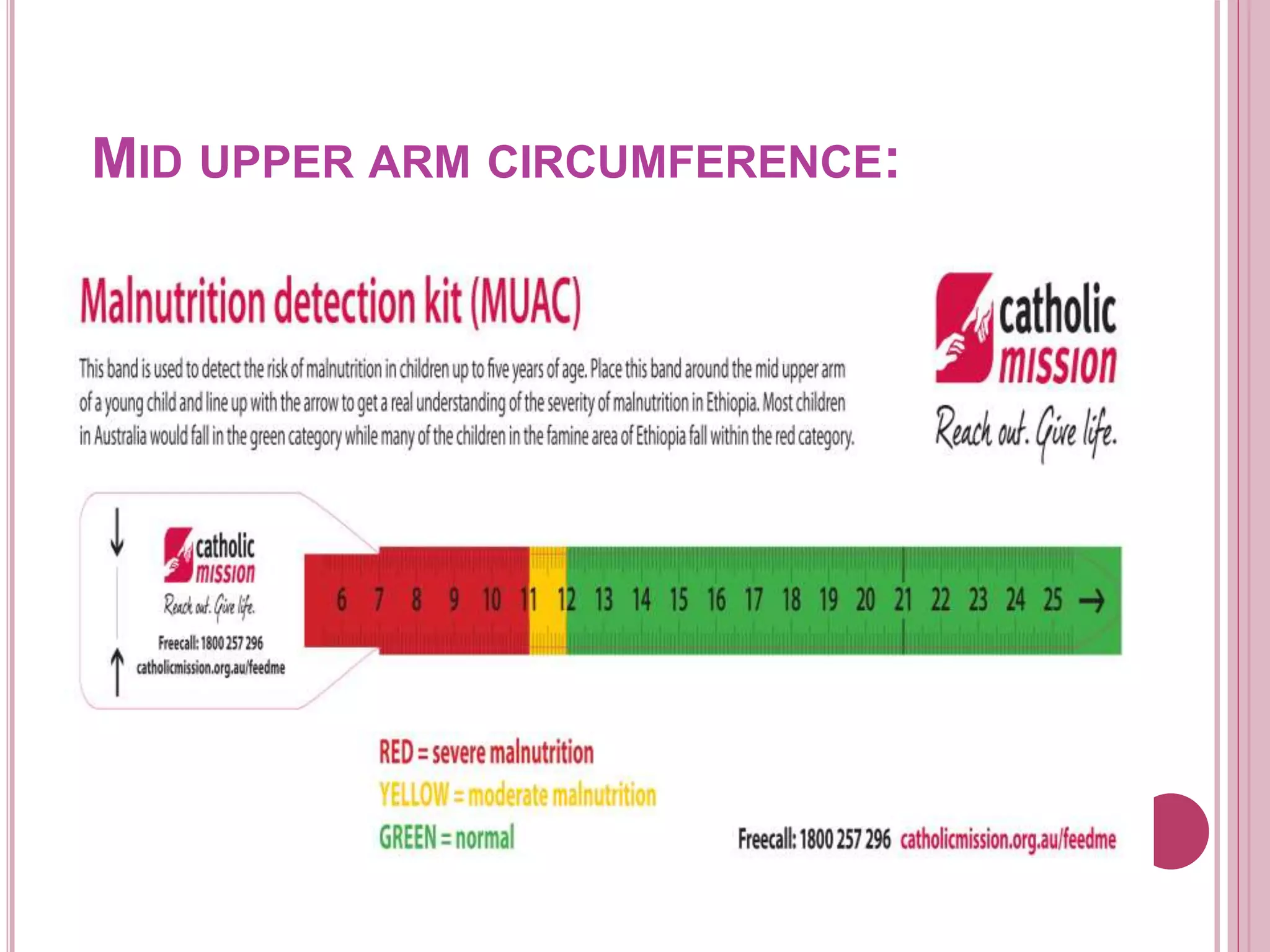 MID UPPER ARM CIRCUMFERENCE:
 