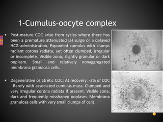 Oocyte Morphology assessment | PPTX