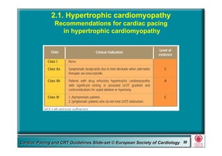 Committee for Practice Guidelines (CPG) 22Committee for Practice Guidelines (CPG) 22Guidelines for Cardiac Pacing and CRT Slide-SetGuidelines for Cardiac Pacing and CRT Slide-SetCardiac Pacing and CRT Guidelines Slide-set © European Society of CardiologyCardiac Pacing and CRT Guidelines Slide-set © European Society of Cardiology 2222
2.1. Hypertrophic cardiomyopathy
Recommendations for cardiac pacing
in hypertrophic cardiomyopathy
 