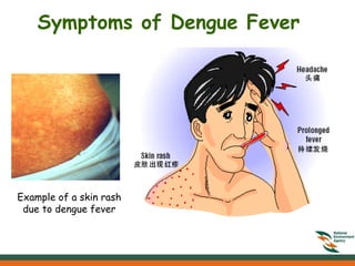 Symptoms of Dengue Fever




    Example of a skin rash
     due to dengue fever
LearnPakistan.Com

Go to http://www.learnpakistan.com/ for
more details about dengue, symptoms,
treatment and prevention.
 