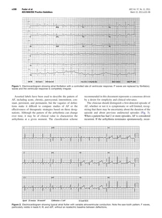 e108      Fuster et al.                                                                                              JACC Vol. 57, No. 11, 2011
          ACC/AHA/ESC Practice Guidelines                                                                              March 15, 2011:e101–98




Figure 1. Electrocardiogram showing atrial ﬁbrillation with a controlled rate of ventricular response. P waves are replaced by ﬁbrillatory
waves and the ventricular response is completely irregular.


   Assorted labels have been used to describe the pattern of            recommended in this document represents a consensus driven
AF, including acute, chronic, paroxysmal, intermittent, con-            by a desire for simplicity and clinical relevance.
stant, persistent, and permanent, but the vagaries of deﬁni-               The clinician should distinguish a ﬁrst-detected episode of
tions make it difﬁcult to compare studies of AF or the                  AF, whether or not it is symptomatic or self-limited, recog-
effectiveness of therapeutic strategies based on these desig-           nizing that there may be uncertainty about the duration of the
nations. Although the pattern of the arrhythmia can change              episode and about previous undetected episodes (Fig. 3).
over time, it may be of clinical value to characterize the              When a patient has had 2 or more episodes, AF is considered
arrhythmia at a given moment. The classiﬁcation scheme                  recurrent. If the arrhythmia terminates spontaneously, recur-




Figure 2. Electrocardiogram showing typical atrial ﬂutter with variable atrioventricular conduction. Note the saw-tooth pattern, F waves,
particularly visible in leads II, III, and aVF, without an isoelectric baseline between deﬂections.
 