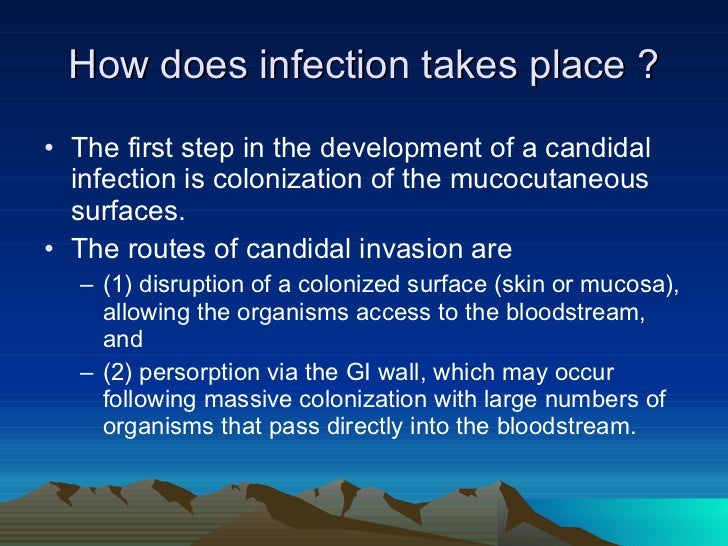 Guidelines for the management of candidiasis
