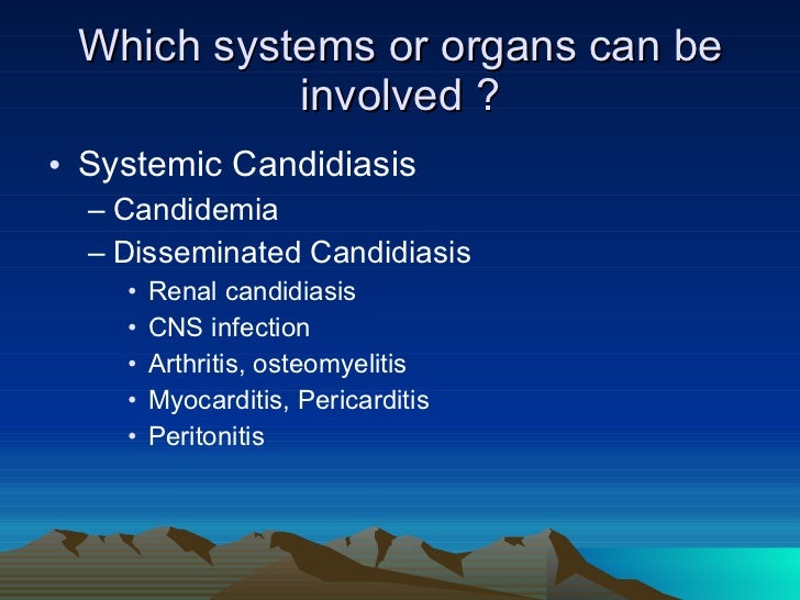 Guidelines for the management of candidiasis