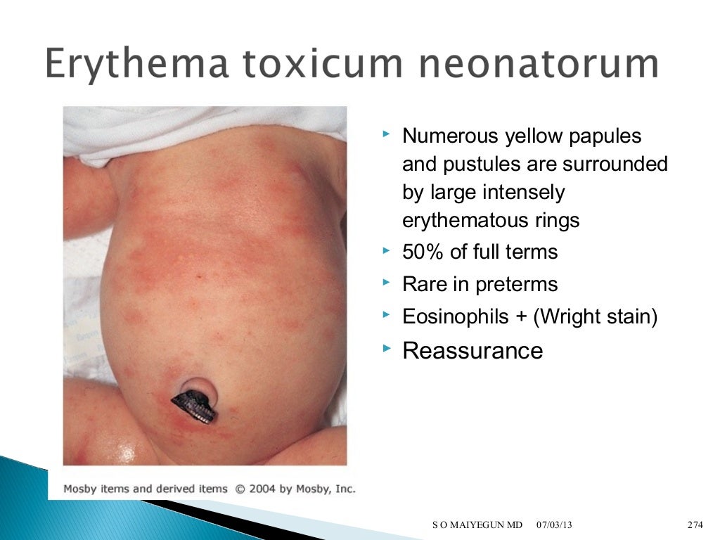 Well Baby Nursery Guidelines