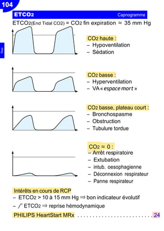 104
CO2 ≈ 0 :
Ŕ Arrêt res
ETCO2(End Tidal CO2) = CO2 fin expiration ≈ 35 mm Hg
CO2 haute :
Ŕ Hypoventilation
Ŕ Sédation
CO2 basse :
Ŕ Hyperventilation
Ŕ VA«espace mort»
CO2 basse, plateau court :
Ŕ Bronchospasme
Ŕ Obstruction
Ŕ Tubulure tordue
Intérêts en cours de RCP
piratoire
Ŕ Extubation
Ŕ intub. oesophagienne
Ŕ Déconnexion respirateur
Ŕ Panne respirateur
Ŕ ETCO2 > 10 à 15 mm Hg ⇒ bon indicateur évolutif
Ŕ /' ETCO2 ⇒ reprise hémodynamique
PHILIPS HeartStart MRx . . . . . . . . . . . . . . . . . . . . . . . . . 24
ETCO2 Capnogramme
Resp
 