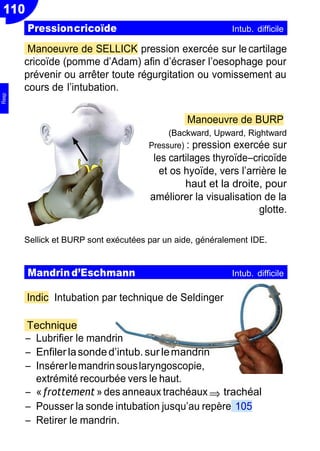 110
⇒
Manoeuvre de SELLICK pression exercée sur lecartilage
cricoïde (pomme d’Adam) afin d’écraser l’oesophage pour
prévenir ou arrêter toute régurgitation ou vomissement au
cours de l’intubation.
Manoeuvre de BURP
(Backward, Upward, Rightward
Pressure) : pression exercée sur
les cartilages thyroïdeŔcricoïde
et os hyoïde, vers l’arrière le
haut et la droite, pour
améliorer la visualisation de la
glotte.
Sellick et BURP sont exécutées par un aide, généralement IDE.
Indic Intubation par technique de Seldinger
Technique
Ŕ Lubrifier le mandrin
Ŕ Enfilerlasonded’intub.sur lemandrin
Ŕ Insérerlemandrinsouslaryngoscopie,
extrémité recourbée vers le haut.
Ŕ «frottement » des anneaux trachéaux trachéal
Ŕ Pousser la sonde intubation jusqu’au repère 105
Ŕ Retirer le mandrin.
Pressioncricoïde Intub. difficile
Mandrind’Eschmann Intub. difficile
Resp
 