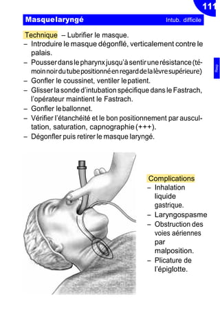 111
Technique Ŕ Lubrifier le masque.
Ŕ Introduire le masque dégonflé, verticalement contre le
palais.
Ŕ Pousserdanslepharynxjusqu’àsentirunerésistance(té-
moinnoirdutubepositionnéenregarddelalèvresupérieure)
Ŕ Gonfler le coussinet, ventiler lepatient.
Ŕ Glisserlasonde d’intubationspécifique dans leFastrach,
l’opérateur maintient le Fastrach.
Ŕ Gonfler leballonnet.
Ŕ Vérifier l’étanchéité et le bon positionnement par auscul-
tation, saturation, capnographie(+++).
Ŕ Dégonfler puis retirer le masque laryngé.
Complications
Ŕ Inhalation
liquide
gastrique.
Ŕ Laryngospasme
Ŕ Obstruction des
voies aériennes
par
malposition.
Ŕ Plicature de
l’épiglotte.
Masquelaryngé Intub. difficile
Resp
 