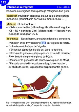 112
Intubation antérograde après passage rétrograde d’un guide
Indication Intubation classique ou sur guide antérograde
impossible (traumatisme cervical ou maxillo-facial . . .)
Matériel Kit de Cook ou :
Ŕ Kit desous-clavière (utiliser l’aiguille etle mandrin-guide)
Ŕ KT 14G + seringue 2 ml (piston retiré) + raccord vert
desondeintubationØ7,5
Technique Ŕ Désinfection, anesthésie locale si conscient.
Ŕ Ponction crico-thyroïdienne 113 paraiguille de fort Ø.
Ŕ Inclinaisoncéphalique del’aiguille.
Ŕ Vérifier par aspiration qu’elle est dans la trachée.
Ŕ Introduire le guide métallique par son extrémité mousse.
Ŕ Fixer l’extrémité par une pince de Péan.
Ŕ Récupérer le guide dans la bouche avec pince de Magill.
Ŕ Glisserlasonded’intubationsurleguideentraction.
Ŕ Siellebute,retirer le guidetoutenpoussant lasonde.
NB : Ponction entre 2e
et 3e
anneau trachéal . risque d’extubation
au retrait du guide, mais / risque de ponction thyroïde.
Intubation rétrograde Intub. difficile
Resp
 
