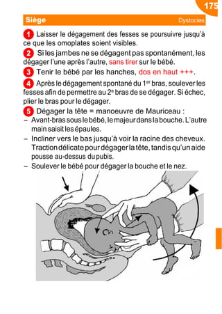 1
2
3
4
5
Laisser le dégagement des fesses se poursuivre jusqu’à
ce que les omoplates soient visibles.
Si les jambes ne se dégagent pas spontanément, les
dégager l’une après l’autre, sans tirer sur le bébé.
Tenir le bébé par les hanches, dos en haut +++.
Après le dégagement spontané du 1er bras, soulever les
fesses afin de permettre au 2e bras de se dégager. Si échec,
plier le bras pour le dégager.
Dégager la tête = manoeuvre de Mauriceau :
Ŕ Avant-brassouslebébé,lemajeurdanslabouche.L’autre
mainsaisitlesépaules.
Ŕ Incliner vers le bas jusqu’à voir la racine des cheveux.
Tractiondélicatepourdégagerlatête,tandisqu’unaide
pousse au-dessus dupubis.
Ŕ Soulever le bébé pour dégager la bouche et le nez.
Obst
175
Siège Dystocies
 