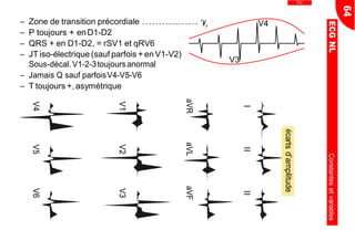 Ŕ Zone de transition précordiale .................
Ŕ P toujours + enD1-D2
Ŕ QRS + en D1-D2, = rSV1 et qRV6
Ŕ JT iso-électrique (sauf parfois + en V1-V2)
Sous-décal.V1-2-3toujoursanormal
Ŕ Jamais Q sauf parfoisV4-V5-V6
Ŕ T toujours +, asymétrique
CV
V4
V3
',
64
ECGNLConstantesetvariables
écartsd’amplitude
IIIII
aVRaVLaVF
V1V2V3
V4V5V6
 