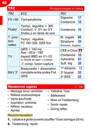 66
CV
Ŕ Massage sinus carotidien
Ŕ Réflexe oculocardiaque
Ŕ Verre eaufroide
Ŕ Inspiration profonde
Ŕ Réflexe nauséeux
Ŕ Apnée
Recommandation
Ŕ Valsalva, Toux
Ŕ Bâillement
Ŕ Mise enTredelenburg
Ŕ Sonde nasale
Ŕ Diving reflex
1. Valsalva àglotteouverte (souffler 15secseringue20ml)
2. Tredelenburg rapide
TRC Principaux troubles du rythme
TRC ECG PEC
FA >90 Tachyarythmie
Digoxine 17
Cordarone 16
Flutter
Tachyc. régulière ≈ 300
Conduct. V. 2/1 ou 3/1
Ondes p en dents de scie
Cordarone 16
T. jonc-
tion-
nelles
Tachyc. régulière,
FC 160Ŕ200, QRS fins
M. vagale 66
Striadyne 39
Krenosin, Isoptine
TV
QRS > 140 ms
Axe−90à−180
Aspect BBD en V1-V2
(« Oreille de lapin » à Gche)
∃ compl. fusion capture
CEEsi Choc ??
Cordarone 16
Xylocaïne 41
Sulf. Mg 28
BAV 3°
Bradycardie + dissociation
complète entre ondes P et
QRS
1er Atropine 12
2e Isuprel 25
3e EEE 22
Manœuvres vagales T. TSV
 