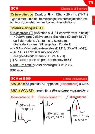 79
−
− ≥
Critère clinique Douleur ♥ < 12h, > 20 min, (TNT )
Typiquement :médio-thoracique (rétrosternale) intense,dé-
but brutal, constrictive, en barre, +/− irradiations.
Critères électriques ST+
Sus-décalage ST (élévation pt J, ST convexe vers le haut) :
Ŕ >0,2mVdans2dérivationsprécordialesDtes(V1àV3)
ou 2 dérivations d’un territoire coronaire.
Onde de Pardee : ST englobant l’onde T
Ŕ > 0,1 mV dérivations frontales (D1,D2, D3, aVL, aVF),
Ŕ si R > S en V2 = faireV7-V8-V9
Ŕ si signes Droits = faire V3R-V4R (VD)
(Ŕ) ST raide : perte de pente et concavité ST
Miroir IDM basal : Sous-décalage ST V1 à V3
BBG récent
BBG isolé 65 polarité ST opposée (discordante) à QRS
BBG + SCA ST+ anomalie « discordance appropriée »
Concordance + Concordance − /' discordance
ST 1mm
V1, V2, ou V3 ST+≥5mm
si QRS −
SCA Diagnostic et Stratégie
SCA et BBG Critères de Sgarbossa
ST+ ≥1mm
si QRS +
CV
 