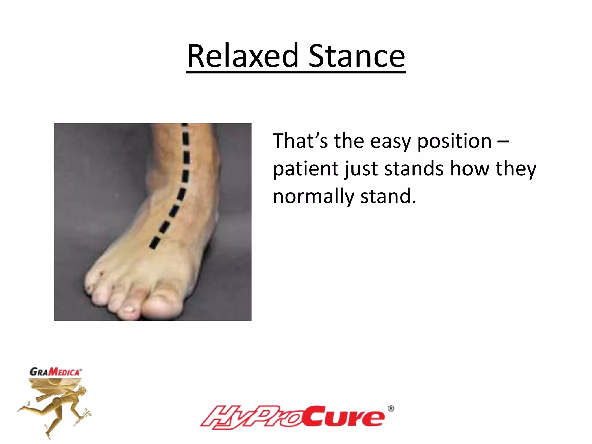 Relaxed Stance
That’s the easy position –
patient just stands how they
normally stand.
 