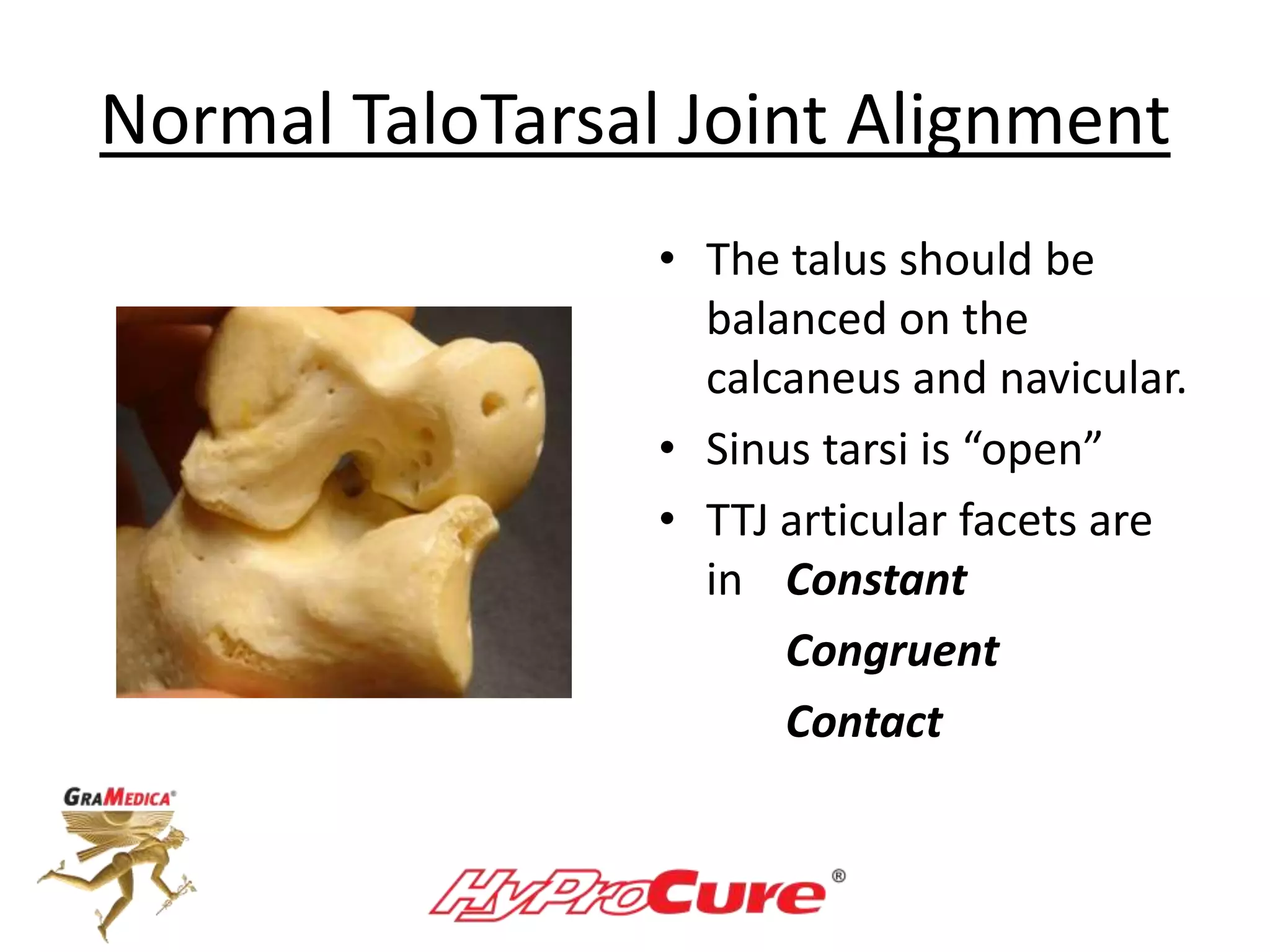 Normal TaloTarsal Joint Alignment
• The talus should be
balanced on the
calcaneus and navicular.
• Sinus tarsi is “open”
• TTJ articular facets are
in Constant
Congruent
Contact
 