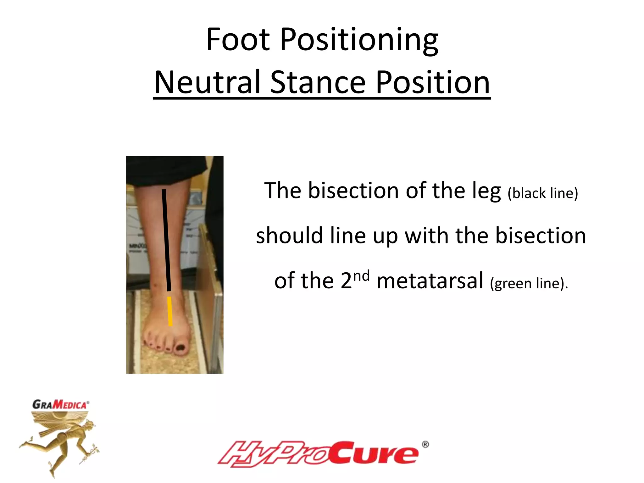 Foot Positioning
Neutral Stance Position
The bisection of the leg (black line)
should line up with the bisection
of the 2nd metatarsal (green line).
 