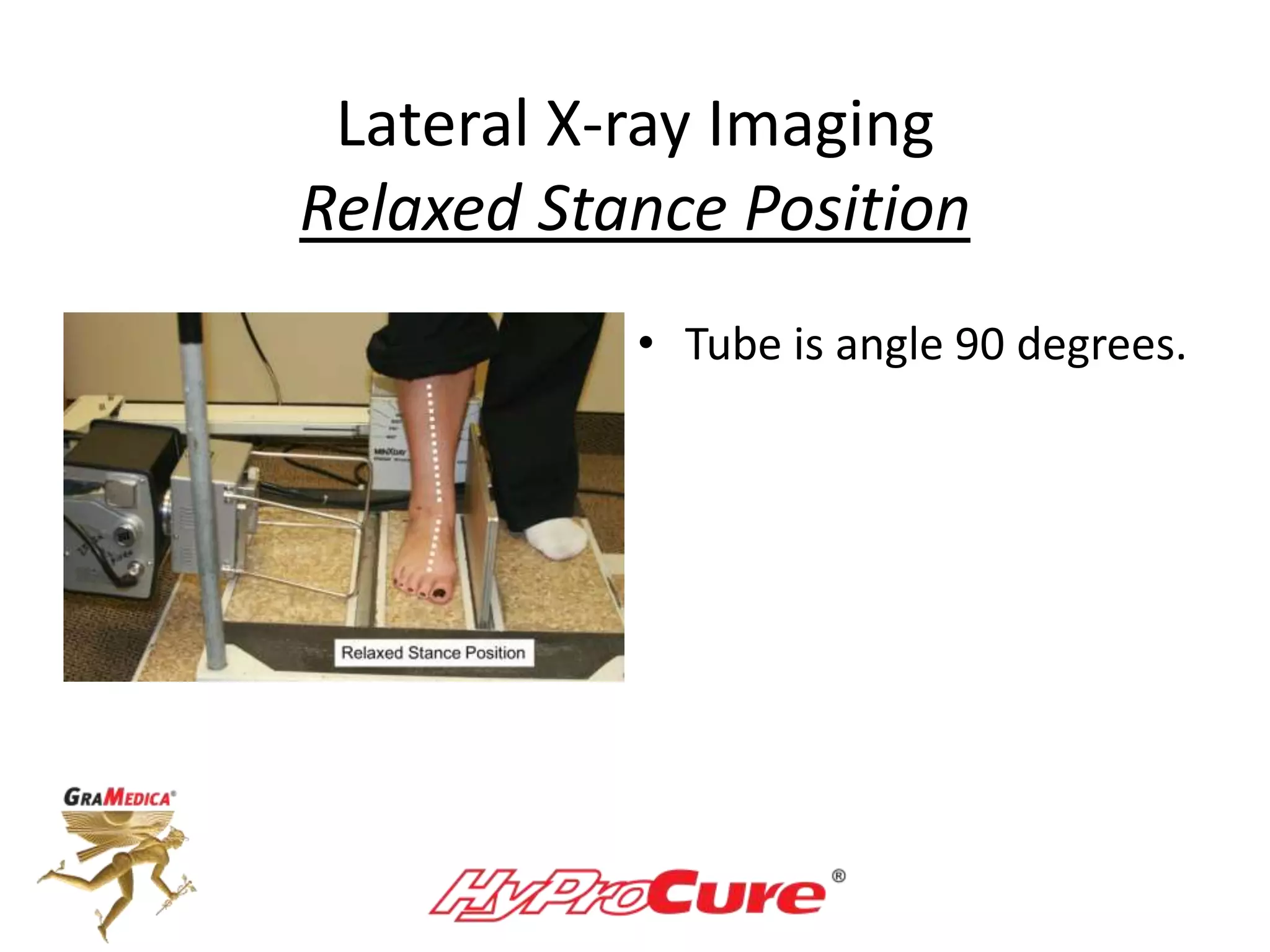 Lateral X-ray Imaging
Relaxed Stance Position
• Tube is angle 90 degrees.
 