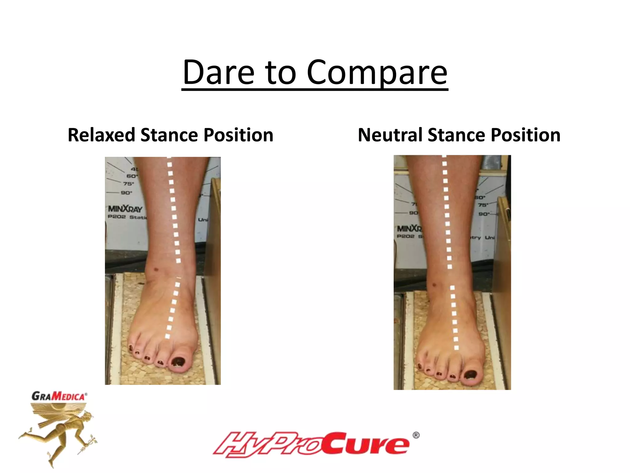 Dare to Compare
Relaxed Stance Position Neutral Stance Position
 