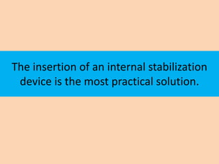 The insertion of an internal stabilization
 device is the most practical solution.
 