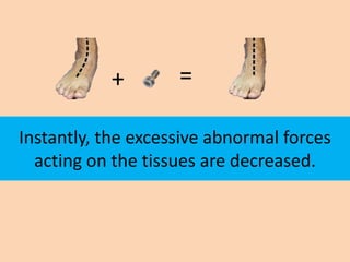 +        =

Instantly, the excessive abnormal forces
  acting on the tissues are decreased.
 