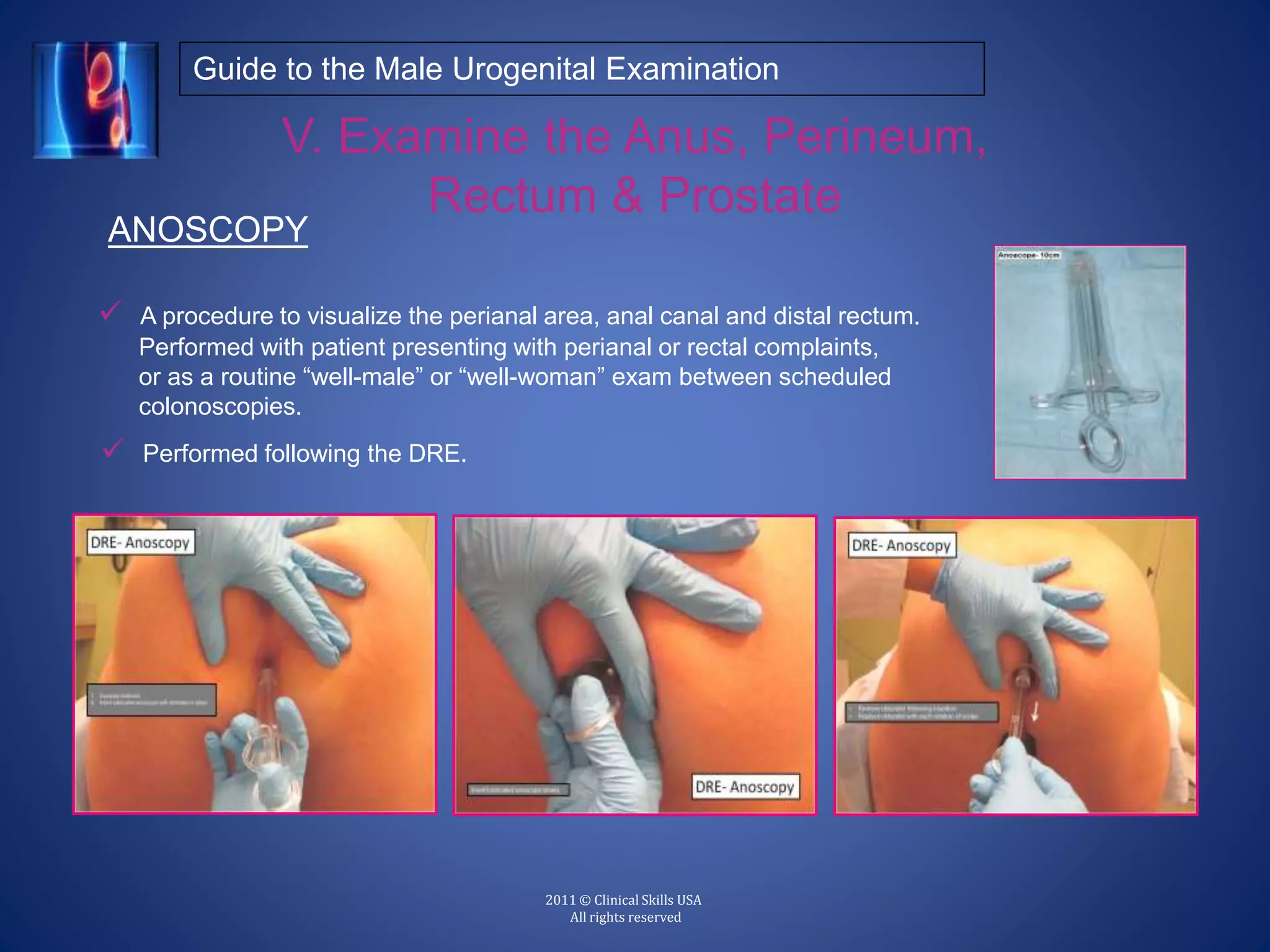 A Guide to the Clinical Male Urogenital Examination PPTX