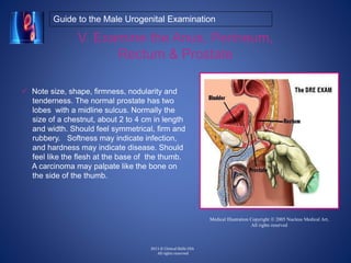 Prostate Chestnut A Guide to the Clinical Male Urogenital Examination | PPTX