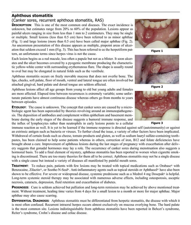 Guide to oral lesions | PDF