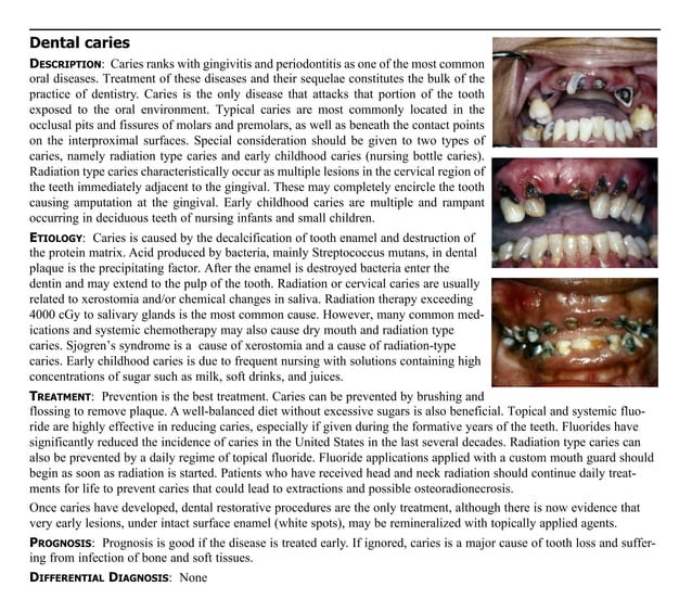 Guide to oral lesions | PDF