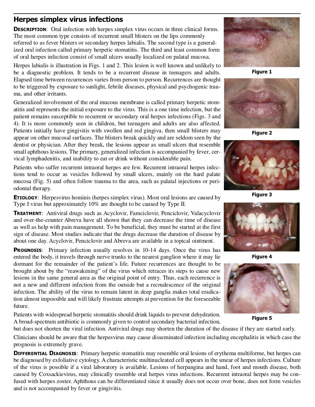 Guide to oral lesions
