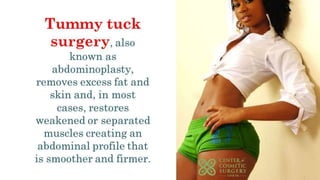 Guide to tummy tuck surgery