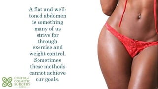 Guide to tummy tuck surgery