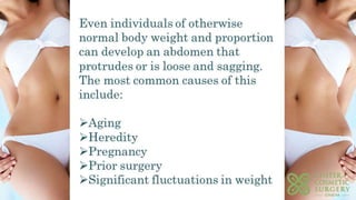 Guide to tummy tuck surgery