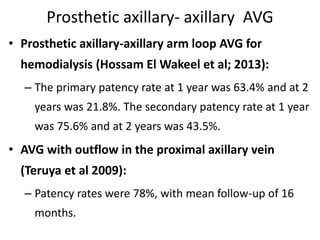 Guidewire induced asystole final | PPTX