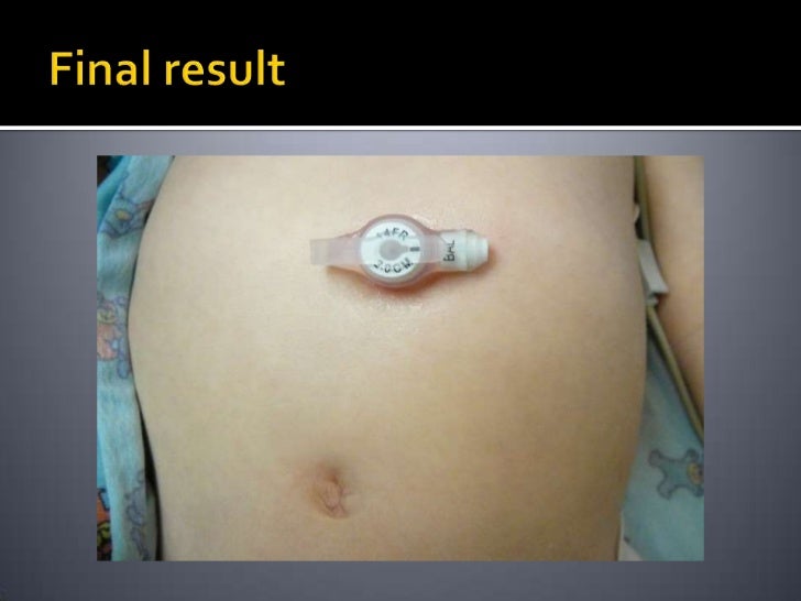 Guidewire Final Presentation Apr 12