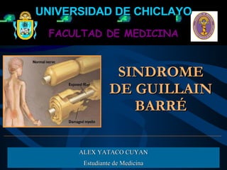 SINDROME DE GUILLAIN BARRÉ ALEX YATACO CUYAN Estudiante de Medicina FACULTAD DE MEDICINA UNIVERSIDAD DE CHICLAYO 
