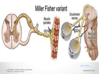 19/08/2018
Pediatric Guillain-Barré syndrome
Prof. Dr .Saad S Al Ani
28
Science Direct
 