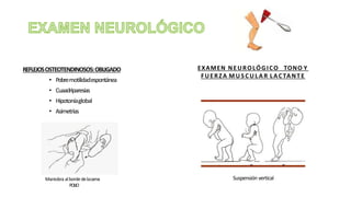 REFLEJOSOSTEOTENDINOSOS:OBLIGADO
• Pobremotilidadespontánea
• Cuaadriparesias
• Hipotoníaglobal
• Asimetrías
EXAMEN NEUROLÓGICO TONO Y
FUERZA M U S C U L A R LACTANTE
Suspensión verticalManiobra albordedelacama
POLIO
 