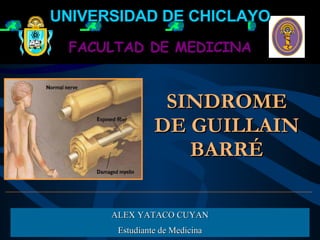 SINDROME DE GUILLAIN BARRÉ ALEX YATACO CUYAN Estudiante de Medicina FACULTAD DE MEDICINA UNIVERSIDAD DE CHICLAYO 