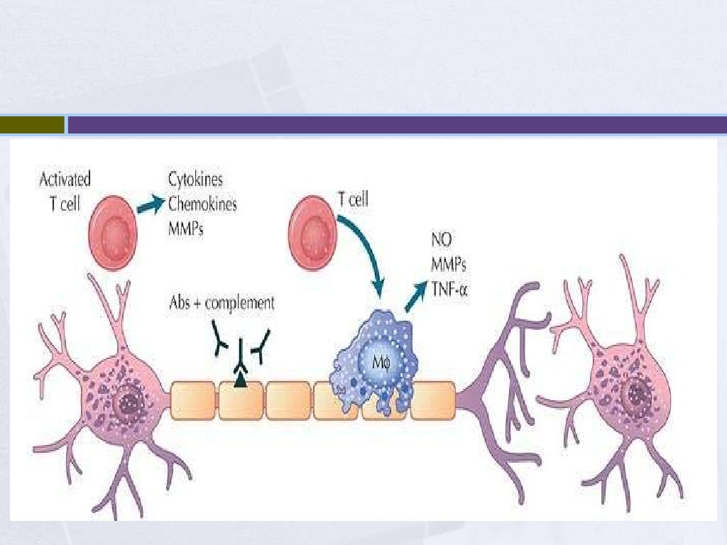 Guillain barre syndrome