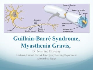 Guillain-Barré Syndrome,
Myasthenia Gravis,
Dr. Nermine Elcokany
Lecturer, Critical Care & Emergency Nursing Department
Alexandria, Egypt
 