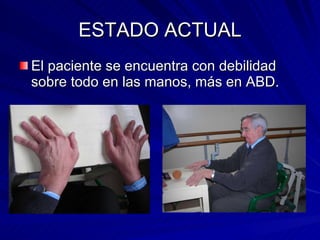ESTADO ACTUAL El paciente se encuentra con debilidad sobre todo en las manos, más en ABD. 