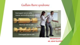 Guillain-Barre syndrome
PRESENTED BY:
MR. ABHAY RAJPOOT
 