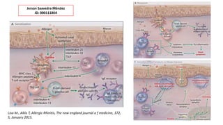 Lisa M., Alkis T, Allergic Rhinitis, The new england journal o f medicine, 372,
5, January 2015.
Jerson Saavedra Méndez
ID: 000111864
 