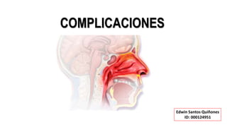 COMPLICACIONES
Edwin Santos Quiñones
ID: 000124951
 