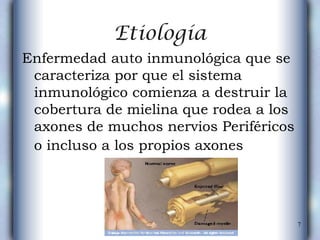 Enfermedad auto inmunológica que se caracteriza por que el sistema inmunológico comienza a destruir la cobertura de mielina que rodea a los axones de muchos nervios Periféricos o incluso a los propios axones   Etiología 