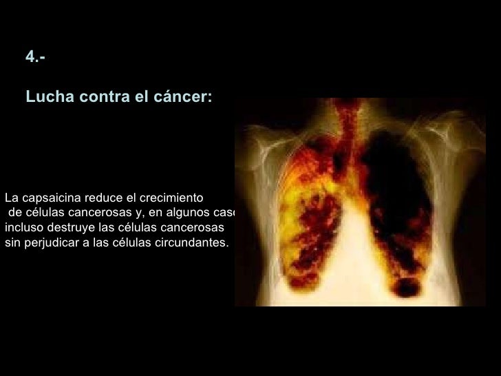 Las sensaciones desagradables en el pie a varikoze
