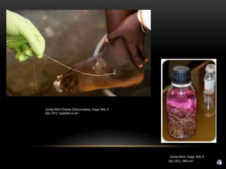 Guinea Worm Disease (Dracunculiasis). Image. Web. 8
Dec. 2012. <guardian.co.uk>




                                                       Guinea Worm. Image. Web. 8
                                                      Dec. 2012. <Who.int>
 