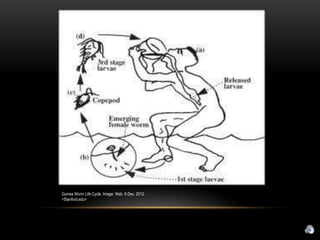Guinea Worm Life Cycle. Image. Web. 8 Dec. 2012.
<Stanford.edu>
 