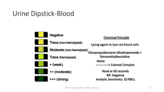 URINE ANALYSIS | PPT