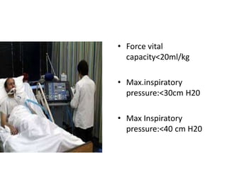 • Force vital
capacity<20ml/kg
• Max.inspiratory
pressure:<30cm H20
• Max Inspiratory
pressure:<40 cm H20